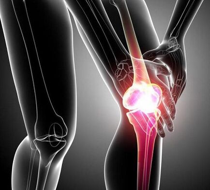 повреждение коленного сустава при артритах и ​​артрозах